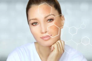 Que sont les taches d'hyperpigmentation ?