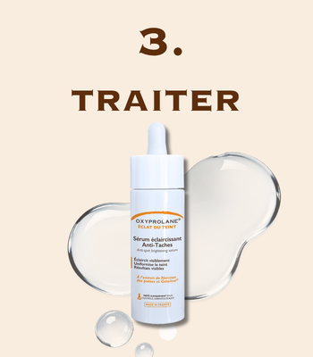 Étape 3 - Traiter