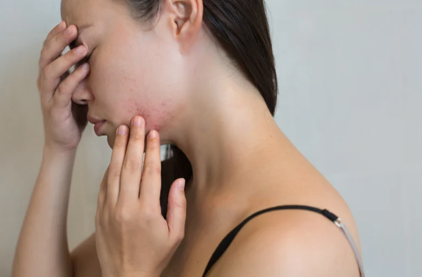 pollution, stress, fatigue, rentrée peau